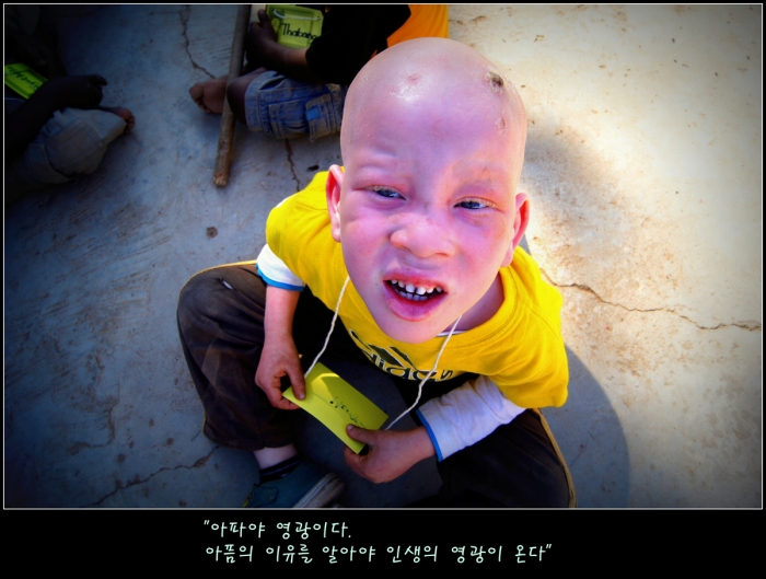 아파야 영광이다